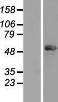 Western Blot: CCDC114 Overexpression Lysate (Adult Normal) [NBP2-05561] Left-Empty vector transfected control cell lysate (HEK293 cell lysate); Right -Over-expression Lysate for CCDC114.