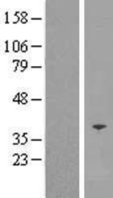 Western Blot: SFXN5 Overexpression Lysate (Adult Normal) [NBP2-05562] Left-Empty vector transfected control cell lysate (HEK293 cell lysate); Right -Over-expression Lysate for SFXN5.