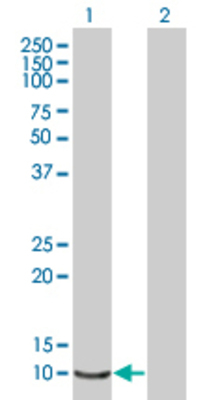 Lane 1: SMR3B transfected lysate (8.69 KDa) Lane 2: Non-transfected lysate.