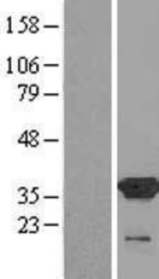 Western Blot: COPE Overexpression Lysate (Adult Normal) [NBL1-09378] Left-Empty vector transfected control cell lysate (HEK293 cell lysate); Right -Over-expression Lysate for COPE.