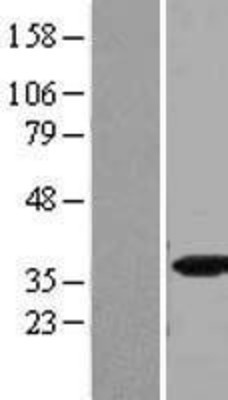 Western Blot: SFRS5 Overexpression Lysate (Adult Normal) [NBP2-11203] Left-Empty vector transfected control cell lysate (HEK293 cell lysate); Right -Over-expression Lysate for SFRS5.