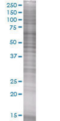 SMR3B transfected lysate.