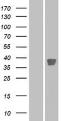 Western Blot: CDK20 Overexpression Lysate (Adult Normal) [NBP2-08533] Left-Empty vector transfected control cell lysate (HEK293 cell lysate); Right -Over-expression Lysate for CDK20.