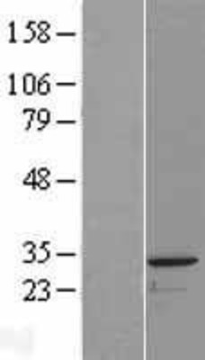 Western Blot: PACRG Overexpression Lysate (Adult Normal) [NBP2-08485] Left-Empty vector transfected control cell lysate (HEK293 cell lysate); Right -Over-expression Lysate for PACRG.