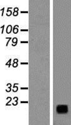 Western Blot: Neuromedin C Overexpression Lysate (Adult Normal) [NBP2-10801] Left-Empty vector transfected control cell lysate (HEK293 cell lysate); Right -Over-expression Lysate for Neuromedin C.
