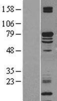 Western Blot: KLC2 Overexpression Lysate (Adult Normal) [NBP2-09555] Left-Empty vector transfected control cell lysate (HEK293 cell lysate); Right -Over-expression Lysate for KLC2.