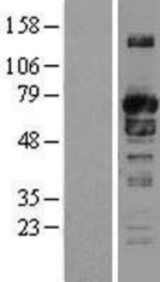 Western Blot: SH3PX1 Overexpression Lysate (Adult Normal) [NBL1-16323] Left-Empty vector transfected control cell lysate (HEK293 cell lysate); Right -Over-expression Lysate for SH3PX1.