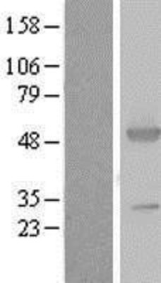 Western Blot: Argininosuccinate Synthase Overexpression Lysate (Adult Normal) [NBL1-07779] Left-Empty vector transfected control cell lysate (HEK293 cell lysate); Right -Over-expression Lysate for Argininosuccinate Synthase.