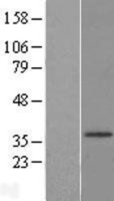 Western Blot: HSD17B3 Overexpression Lysate (Adult Normal) [NBL1-11727] Left-Empty vector transfected control cell lysate (HEK293 cell lysate); Right -Over-expression Lysate for HSD17B3.