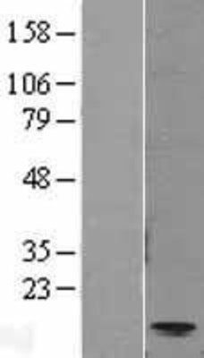 Western Blot: Eotaxin Overexpression Lysate (Adult Normal) [NBL1-08842] Left-Empty vector transfected control cell lysate (HEK293 cell lysate); Right -Over-expression Lysate for Eotaxin.
