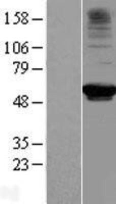 Western Blot: RRP9 Overexpression Lysate (Adult Normal) [NBL1-15593] Left-Empty vector transfected control cell lysate (HEK293 cell lysate); Right -Over-expression Lysate for RRP9.