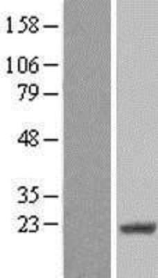 Western Blot: CIRBP Overexpression Lysate (Adult Normal) [NBL1-09212] Left-Empty vector transfected control cell lysate (HEK293 cell lysate); Right -Over-expression Lysate for CIRBP.