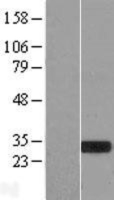 Western Blot: MXI1 Overexpression Lysate (Adult Normal) [NBL1-13408] Left-Empty vector transfected control cell lysate (HEK293 cell lysate); Right -Over-expression Lysate for MXI1.