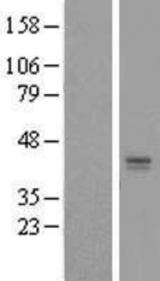 Western Blot: LASS2 Overexpression Lysate (Adult Normal) [NBL1-12441] Left-Empty vector transfected control cell lysate (HEK293 cell lysate); Right -Over-expression Lysate for LASS2.