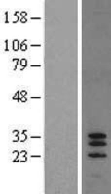 Western Blot: SPACA7 Overexpression Lysate (Adult Normal) [NBL1-08161] Left-Empty vector transfected control cell lysate (HEK293 cell lysate); Right -Over-expression Lysate for SPACA7.