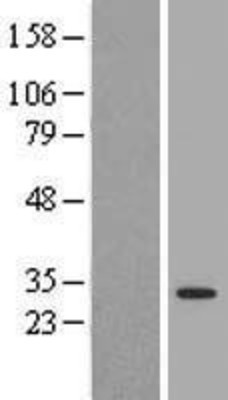 Western Blot: 14-3-3 tau/theta Overexpression Lysate (Adult Normal) [NBL1-17951] Left-Empty vector transfected control cell lysate (HEK293 cell lysate); Right -Over-expression Lysate for 14-3-3 tau/theta.