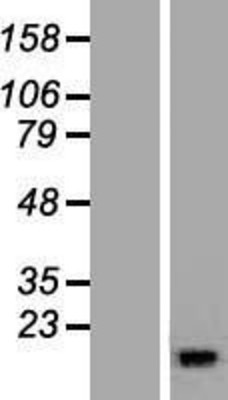Western Blot: RBP5 Overexpression Lysate (Adult Normal) [NBL1-15229] Left-Empty vector transfected control cell lysate (HEK293 cell lysate); Right -Over-expression Lysate for RBP5.
