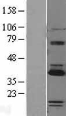 Western Blot: PARP16 Overexpression Lysate (Adult Normal) [NBL1-14114] Left-Empty vector transfected control cell lysate (HEK293 cell lysate); Right -Over-expression Lysate for PARP16.