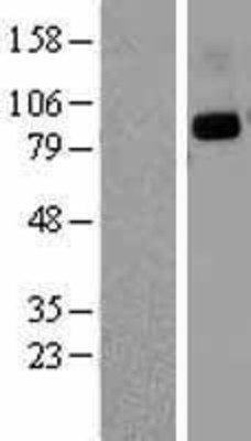 Western Blot: CD26 Overexpression Lysate (Adult Normal) [NBL1-09997] Left-Empty vector transfected control cell lysate (HEK293 cell lysate); Right -Over-expression Lysate for CD26.