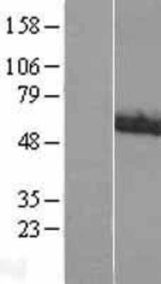 Western Blot: ACCN1 Overexpression Lysate (Adult Normal) [NBL1-07230] Left-Empty vector transfected control cell lysate (HEK293 cell lysate); Right -Over-expression Lysate for ACCN1.