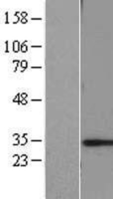 Western Blot: CHMP6 Overexpression Lysate (Adult Normal) [NBL1-09163] Left-Empty vector transfected control cell lysate (HEK293 cell lysate); Right -Over-expression Lysate for CHMP6.