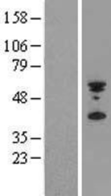 Western Blot: PYHIN1 Overexpression Lysate (Adult Normal) [NBL1-15023] Left-Empty vector transfected control cell lysate (HEK293 cell lysate); Right -Over-expression Lysate for PYHIN1.