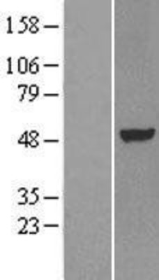 Western Blot: LXR alpha Overexpression Lysate (Adult Normal) [NBL1-13768] Left-Empty vector transfected control cell lysate (HEK293 cell lysate); Right -Over-expression Lysate for LXR alpha.