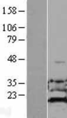Western Blot: ADI1 Overexpression Lysate (Adult Normal) [NBL1-07340] Left-Empty vector transfected control cell lysate (HEK293 cell lysate); Right -Over-expression Lysate for ADI1.