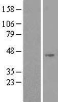 Western Blot: NOXO1 Overexpression Lysate (Adult Normal) [NBL1-13736] Left-Empty vector transfected control cell lysate (HEK293 cell lysate); Right -Over-expression Lysate for NOXO1.