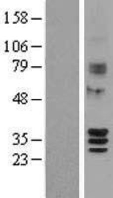 Western Blot: SIRT4 Overexpression Lysate (Adult Normal) [NBL1-15977] Left-Empty vector transfected control cell lysate (HEK293 cell lysate); Right -Over-expression Lysate for SIRT4.