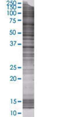 C10orf59 transfected lysate.