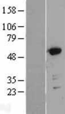 Western Blot: GRASP55 Overexpression Lysate (Adult Normal) [NBL1-11203] Left-Empty vector transfected control cell lysate (HEK293 cell lysate); Right -Over-expression Lysate for GRASP55.