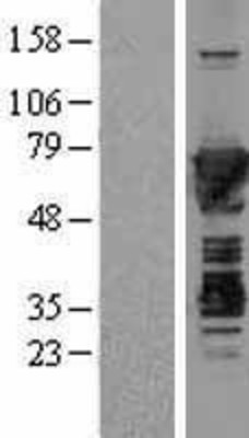 Western Blot: Moesin Overexpression Lysate (Adult Normal) [NBL1-13334] Left-Empty vector transfected control cell lysate (HEK293 cell lysate); Right -Over-expression Lysate for Moesin.