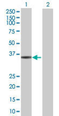 Lane 1: C10orf59 transfected lysate (37.73 KDa) Lane 2: Non-transfected lysate.
