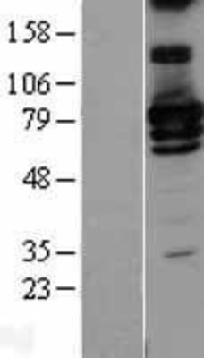 Western Blot: RALBP1 Overexpression Lysate (Adult Normal) [NBL1-15132] Left-Empty vector transfected control cell lysate (HEK293 cell lysate); Right -Over-expression Lysate for RALBP1.
