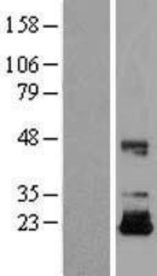 Western Blot: IGF2 Overexpression Lysate (Adult Normal) [NBL1-11868] Left-Empty vector transfected control cell lysate (HEK293 cell lysate); Right -Over-expression Lysate for IGF2.