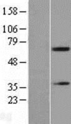 Western Blot: Acetylcholinesterase Overexpression Lysate (Adult Normal) [NBL1-07238] Left-Empty vector transfected control cell lysate (HEK293 cell lysate); Right -Over-expression Lysate for Acetylcholinesterase.