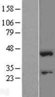 Western Blot: SOX1 Overexpression Lysate (Adult Normal) [NBL1-16343] Left-Empty vector transfected control cell lysate (HEK293 cell lysate); Right -Over-expression Lysate for SOX1.