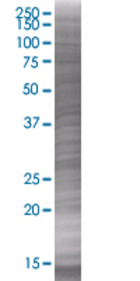TPSAB1 transfected lysate