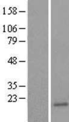Western Blot: Ube2B Overexpression Lysate (Adult Normal) [NBL1-17513] Left-Empty vector transfected control cell lysate (HEK293 cell lysate); Right -Over-expression Lysate for Ube2B.