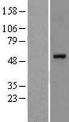 Western Blot: PPAR alpha Overexpression Lysate (Adult Normal) [NBL1-14631] Left-Empty vector transfected control cell lysate (HEK293 cell lysate); Right -Over-expression Lysate for PPAR alpha.