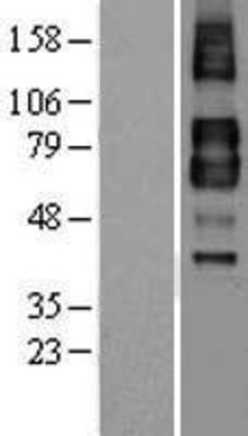 Western Blot: TGF beta Receptor II Overexpression Lysate (Adult Normal) [NBL1-16857] Left-Empty vector transfected control cell lysate (HEK293 cell lysate); Right -Over-expression Lysate for TGF beta Receptor II.