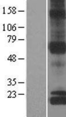 Western Blot: NDUFS8 Overexpression Lysate (Adult Normal) [NBL1-13566] Left-Empty vector transfected control cell lysate (HEK293 cell lysate); Right -Over-expression Lysate for NDUFS8.