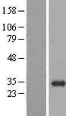 Western Blot: BPGM Overexpression Lysate (Adult Normal) [NBP2-04649] Left-Empty vector transfected control cell lysate (HEK293 cell lysate); Right -Over-expression Lysate for BPGM.