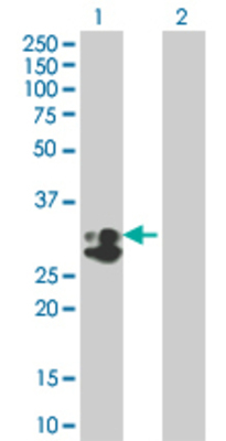 Lane 1: TPSAB1 transfected lysate (30.36 KDa). Lane 2: Non-transfected lysate.