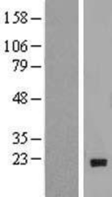 Western Blot: MTH1 Overexpression Lysate (Adult Normal) [NBP2-04634] Left-Empty vector transfected control cell lysate (HEK293 cell lysate); Right -Over-expression Lysate for MTH1.