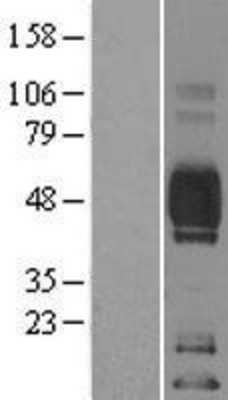 Western Blot: CD2 Overexpression Lysate (Adult Normal) [NBL1-08916] Left-Empty vector transfected control cell lysate (HEK293 cell lysate); Right -Over-expression Lysate for CD2.
