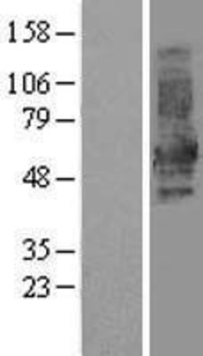 Western Blot: DOK1 Overexpression Lysate (Adult Normal) [NBL1-09977] Left-Empty vector transfected control cell lysate (HEK293 cell lysate); Right -Over-expression Lysate for DOK1.