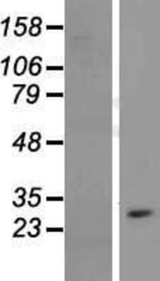 Western Blot: CYB561D1 Overexpression Lysate (Adult Normal) [NBL1-09649] Left-Empty vector transfected control cell lysate (HEK293 cell lysate); Right -Over-expression Lysate for CYB561D1.