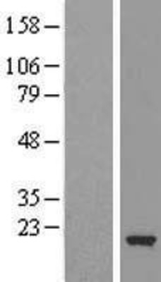 Western Blot: Cofilin 2 Overexpression Lysate (Adult Normal) [NBL1-09127] Left-Empty vector transfected control cell lysate (HEK293 cell lysate); Right -Over-expression Lysate for Cofilin 2.